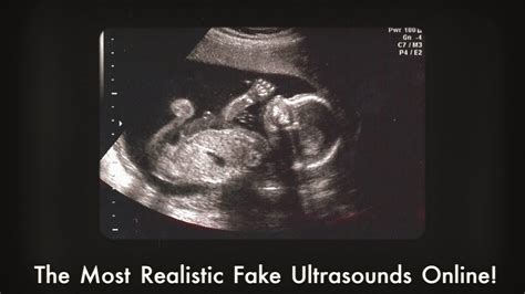 99 3D Black &. . Fake ultrasound photos